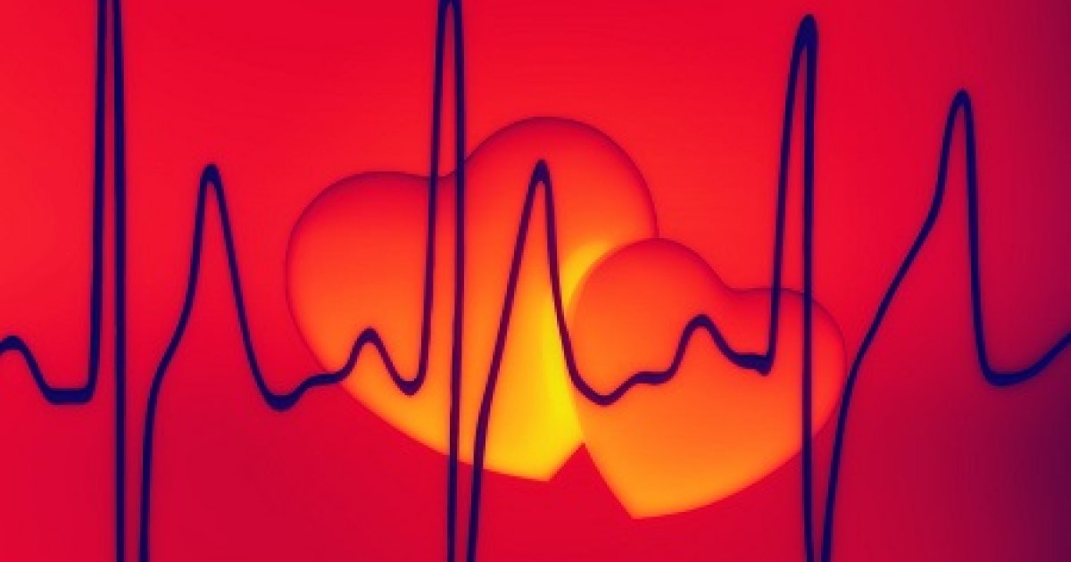 szív tachycardia és magas vérnyomás