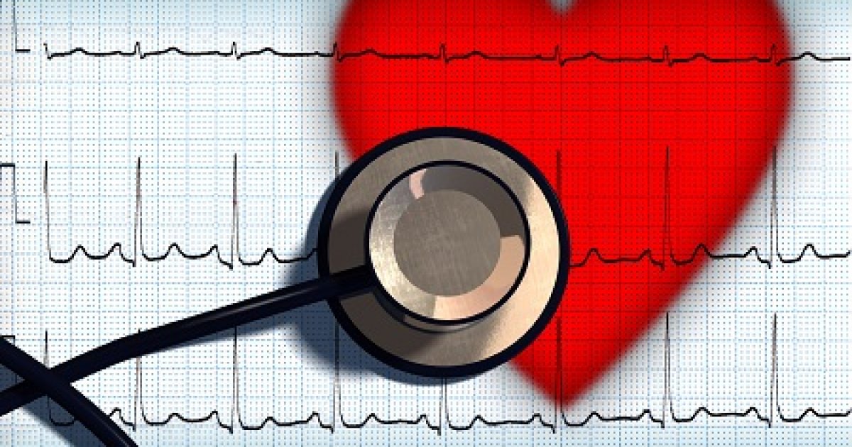 EKG elemzés magas vérnyomás esetén)