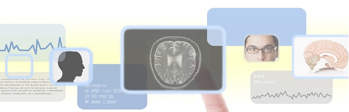 Stroke megelőzése