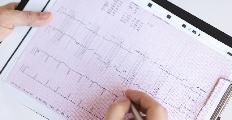 12 elvezetéses EKG vizsgálat