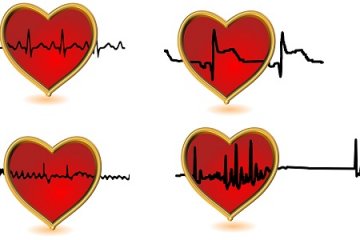 Mikor ajánlott és mikor nem a terheléses EKG?