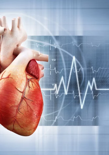Gyakori kérdések és válaszok a szívrohamról