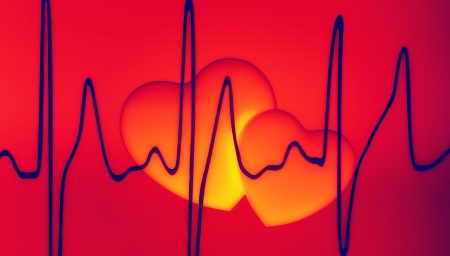 Erős szívdobogás? Így ellenőrizzük a pulzusunkat!