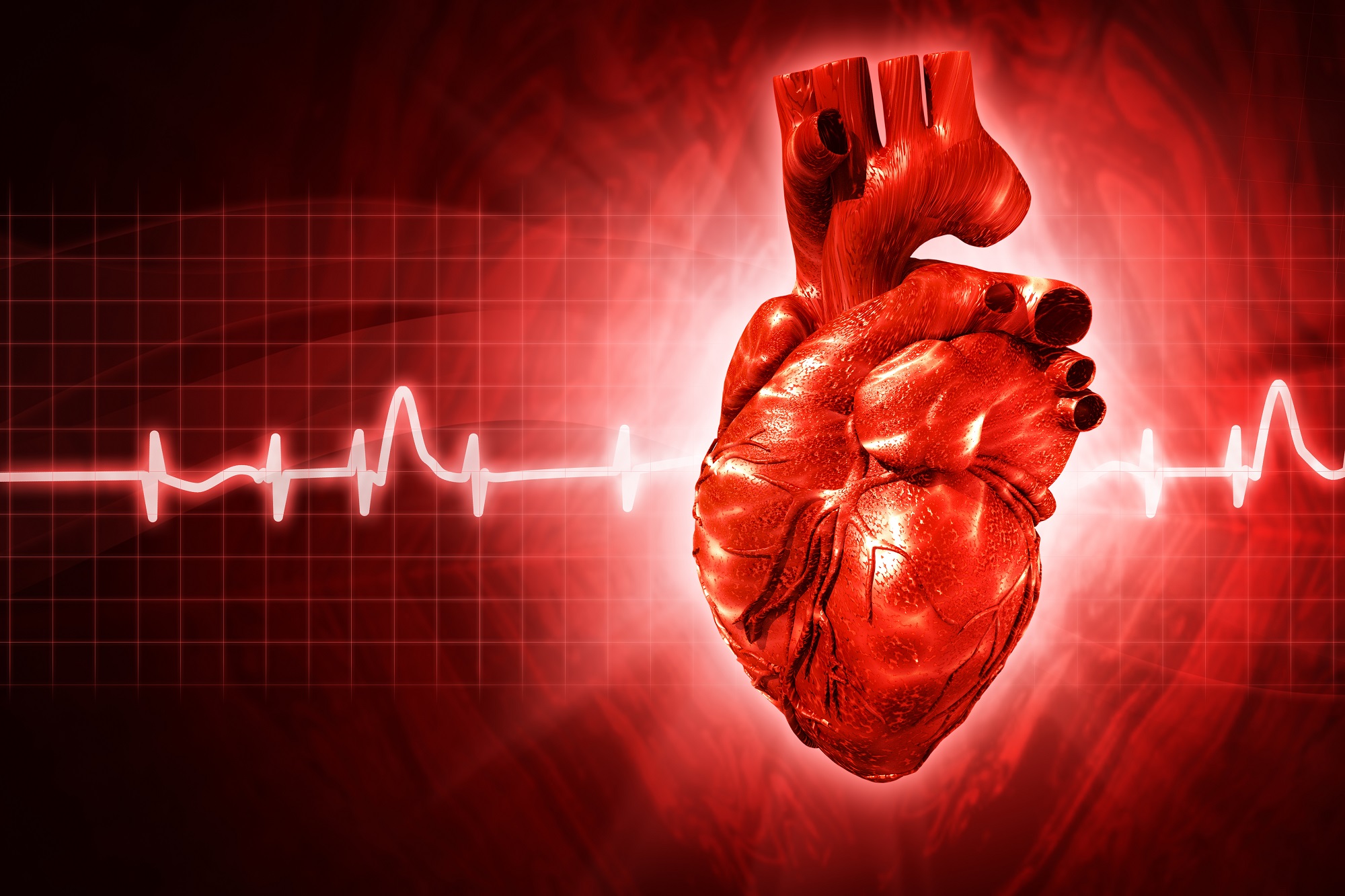 magas vérnyomású szívinfarktus