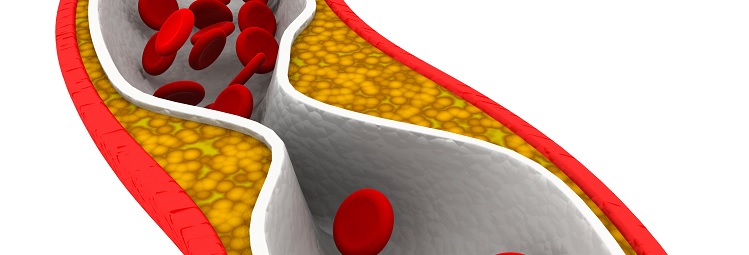 Normál koleszterinszint: mitől függ és mikor kell aggódni? - EgészségKalauz