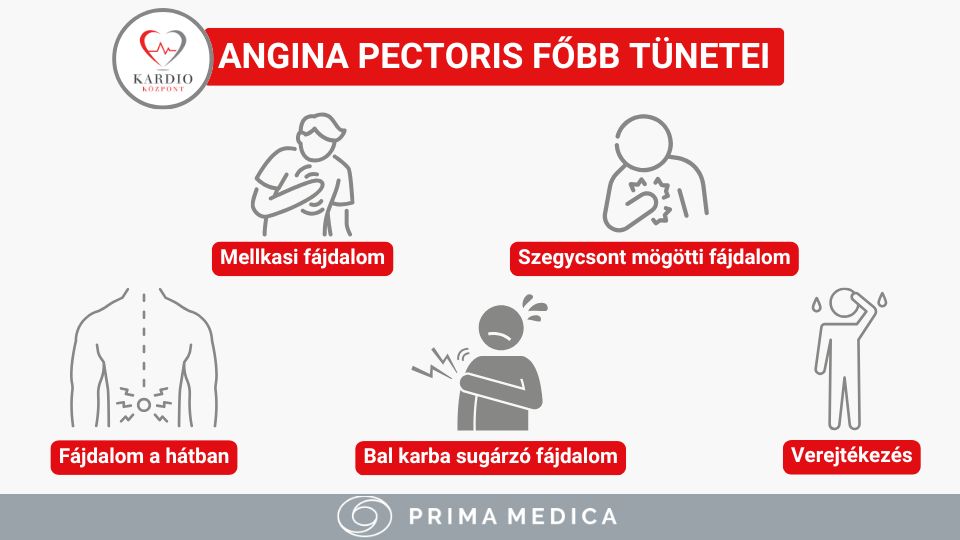 Angina pectoris - Kardioközpont