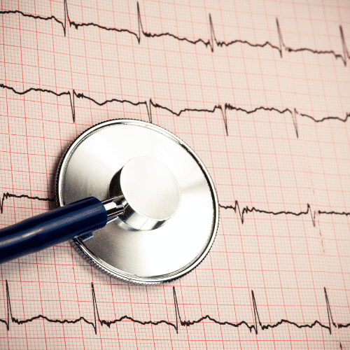 Holter EKG előnyei