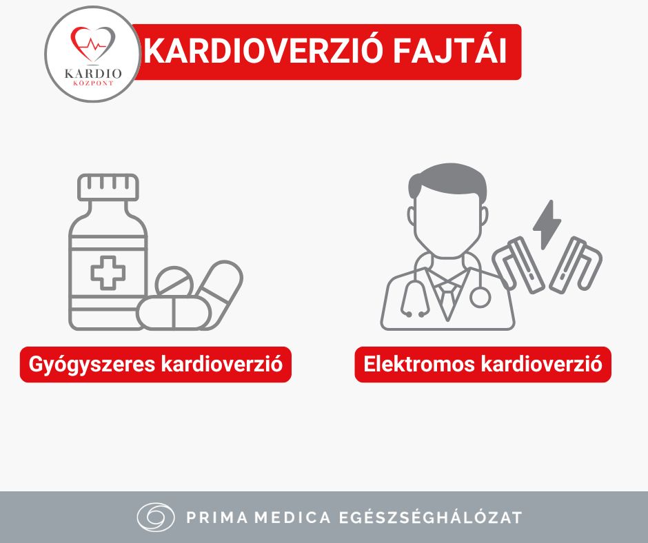 Kardioverzió - Kardioközpont