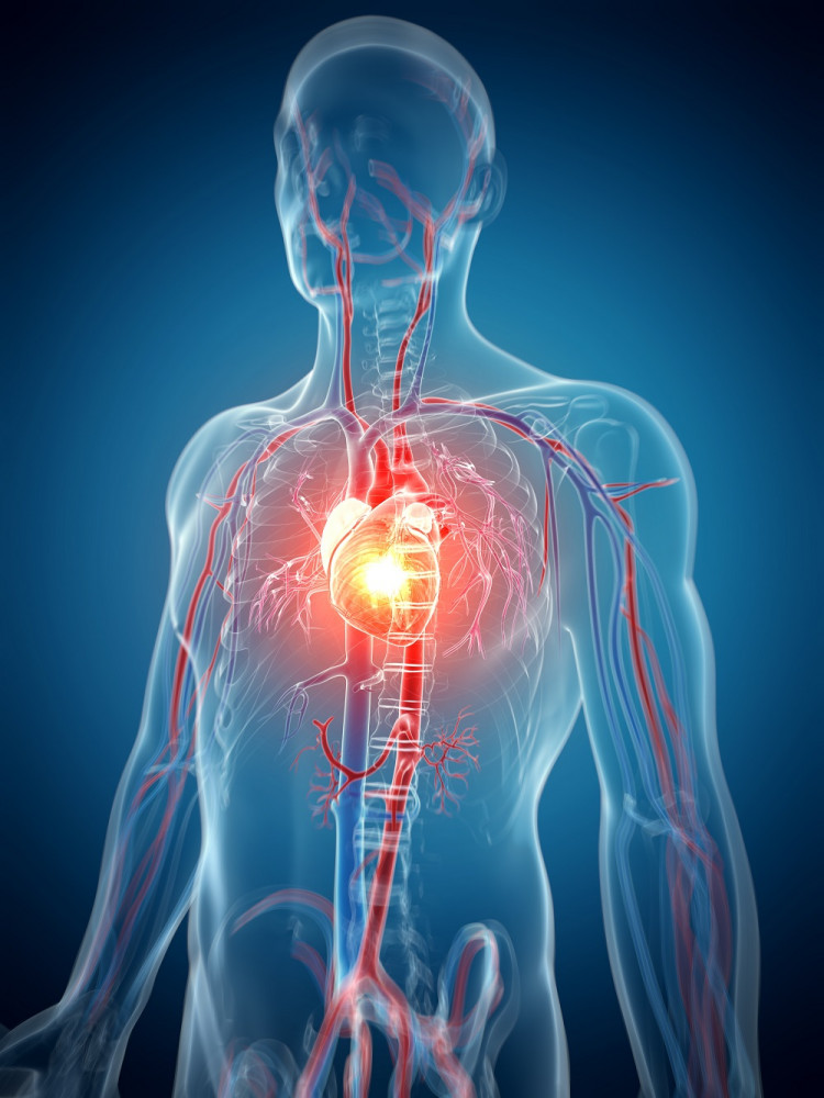 A szívroham (infarktus) tünetei és kezelése a mentők megérkezéséig