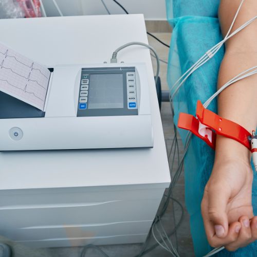 Mikor szükséges nyugalmi és mikor terheléses EKG? - Kardioközpont