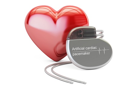pacemaker magas vérnyomás esetén
