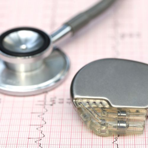 Pacemaker programozás - Kardioközpont