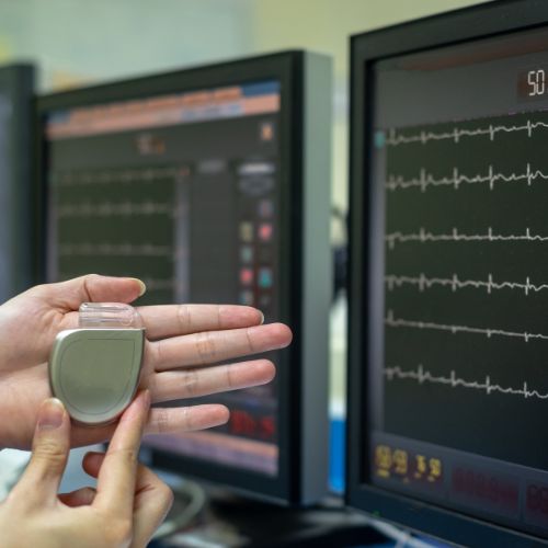 Pacemaker programozása - Kardioközpont