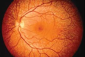 retina vizsgálata 
