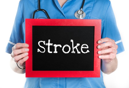 A 7 napos ekg nagyon fontos lehet mini stroke-on átesett betegeknek.