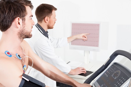 A terheléses EKG során felfedezett rendellenesség előre jelezheti az infarktust.